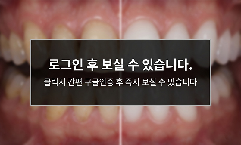구글 로그인